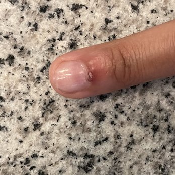 Qnail Bar - The most painful thing I have ever witnessed in a nail salon - Skin Care Near Me - Goodyear, Arizona Qnail Bar - The most painful thing I have ever witnessed in a nail salon - Skin Care Near Me - Goodyear, Arizona