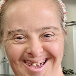 Marston Orthodontics - Before