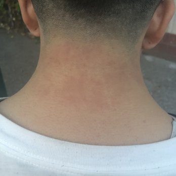 Rudy's Barbershop - My neck skin is messed up from the razor burn - Barbers Near Me - Seattle, Washington Rudy's Barbershop - My neck skin is messed up from the razor burn - Barbers Near Me - Seattle, Washington