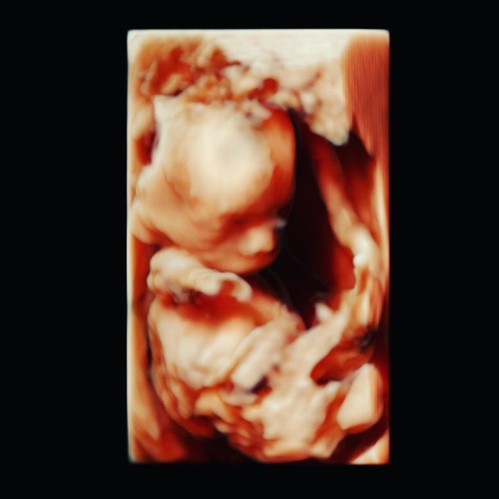 Greggory R Devore, MD - 32 weeks my man would not stop moving but doctor still got a shot - Obstetricians & Gynecologists Near Me - Tarzana, California