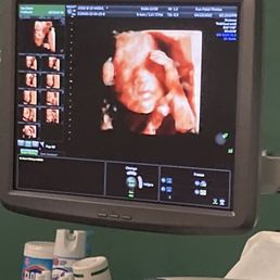 3D photo of my baby! 3D photo of my baby!