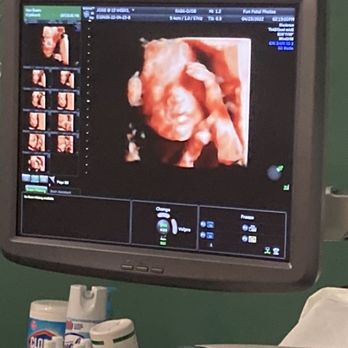 Fun Fetal Photos - 3D photo of my baby! - Diagnostic Imaging Near Me - Hampton, Virginia Fun Fetal Photos - 3D photo of my baby! - Diagnostic Imaging Near Me - Hampton, Virginia