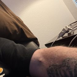 Right arm.