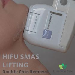 Lime Skin Care - Double Chin removal with Utims Smas Lifting