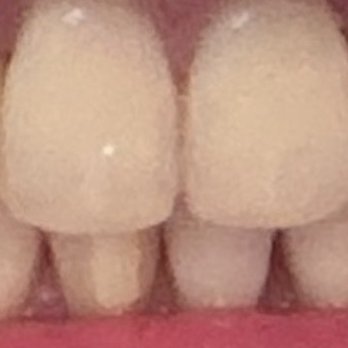 Lee Amy Yen-Ping, DDS - Orthodontists Near Me - Los Altos, California Lee Amy Yen-Ping, DDS - Orthodontists Near Me - Los Altos, California