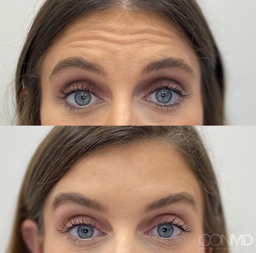 Icon MD Medical Spa + Laser Center Logo