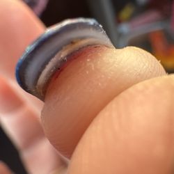 Vivid Nails & Spa - Crusty blood from being cut along my skin where the nail meets