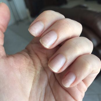 Neon Nails - Poor gel manicure removal. I was charged $10 for this. - Nail Salons Near Me - Chandler, Arizona