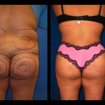 West Hills Plastic Surgery - Plastic Surgeons Near Me - Los Angeles, California West Hills Plastic Surgery - Plastic Surgeons Near Me - Los Angeles, California