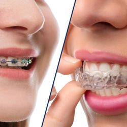 Worcester Quality Dental - Michel Damerji, DDS - Worcester Invisalign Dentist