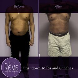 Rêve Body Sculpting - Before and After