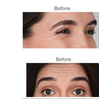 SpaBeautyMD - Medical Spas Near Me - Kirkland, Washington SpaBeautyMD - Medical Spas Near Me - Kirkland, Washington