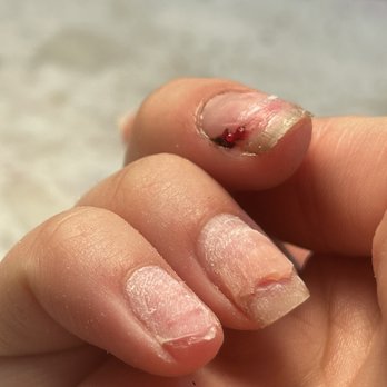 Beyond Nails - blood - Nail Salons Near Me - Sparks, Nevada