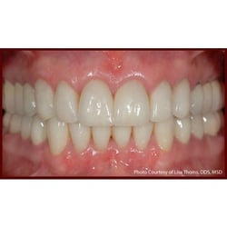 Terry L LaBell, DDS, MS, PhD - After