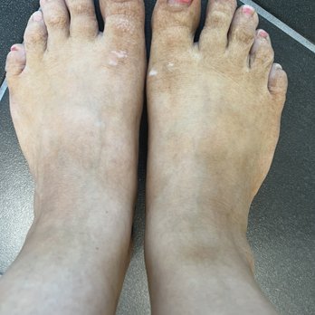Island Glow Spray Tanning - Sweat resistant tan after first rinse. Believe it or not, this looked worse before I showered. Over $50 for this. - Spray Tanning Near Me - Powhatan, Virginia