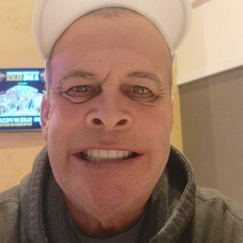Bionic Smile - My new Teefs - Cosmetic Dentists Near Me - Las Vegas, Nevada