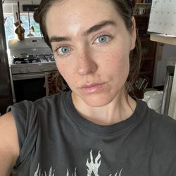 Post facial and extraction