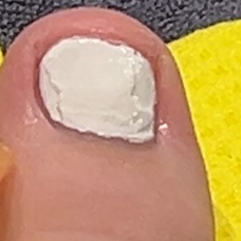 Tipsy - This is a picture of my pedicure and they painted right over nail glue on my toe and did not give any care in the world to buff it off - Nail Salons Near Me - Wellington, Florida Tipsy - This is a picture of my pedicure and they painted right over nail glue on my toe and did not give any care in the world to buff it off - Nail Salons Near Me - Wellington, Florida
