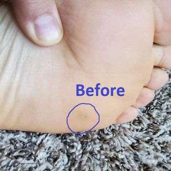 Whatcom Regional Foot and Ankle Specialists - Podiatrists Near Me - Bellingham, Washington Whatcom Regional Foot and Ankle Specialists - Podiatrists Near Me - Bellingham, Washington