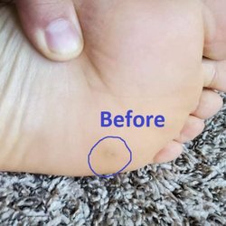 Whatcom Regional Foot and Ankle Specialists