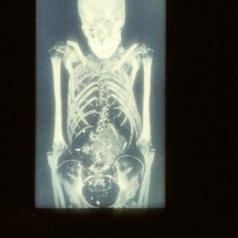 Buffalo Museum of Science - Mummy xray - Museums Near Me - Buffalo, New York Buffalo Museum of Science - Mummy xray - Museums Near Me - Buffalo, New York