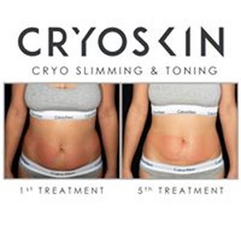 Evolve Beauty Bar - Cryoskin - Permanent Makeup Near Me - Elmhurst, Illinois