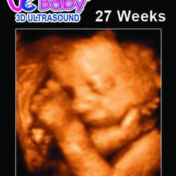 UC Baby - 3D Ultrasound