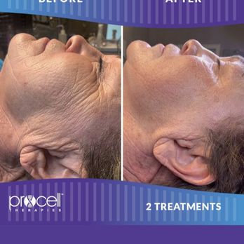 Jamie Nicole Esthetics - Procell MicroChanneling - Skin Care Near Me - Honolulu, Hawaii Jamie Nicole Esthetics - Procell MicroChanneling - Skin Care Near Me - Honolulu, Hawaii