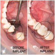 BINH P PHAM, DDS - Updated November 2025 - 12 Photos & 11