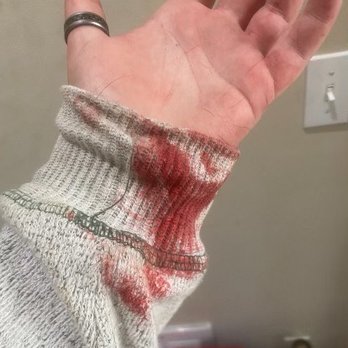 Lenox Farms - Blood from my dogs injuries - Apartments Near Me - Braintree, Massachusetts