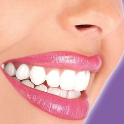 Elite Smile - Average shade of whitening is 2-3 shades lighter per 20 minute session!