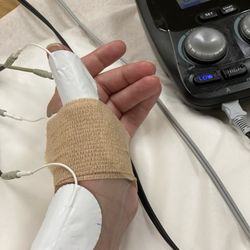 Rebecca S Yu, MD - Post surgery rehab