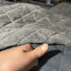 Children's Orthopedics and Sports Medicine - Cherokee - Left thumb