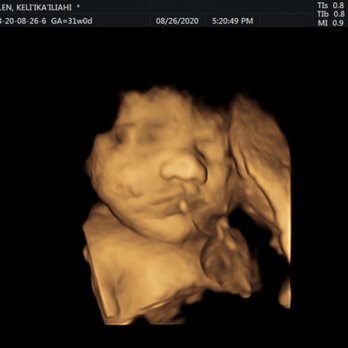 Prenatal Cinemas - Ultrasound Imaging Centers Near Me - Harbor City, California