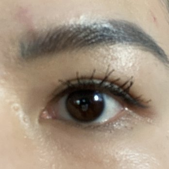 YokoMD - Fixed by Dr. Suzuki with Malibotsu - Medical Spas Near Me - Pasadena, California