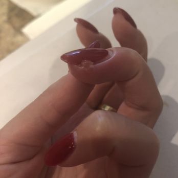X-Nail & Spa - An infected cuticle/nail - the term for it is Paronychia - Nail Salons Near Me - Toronto, Ontario