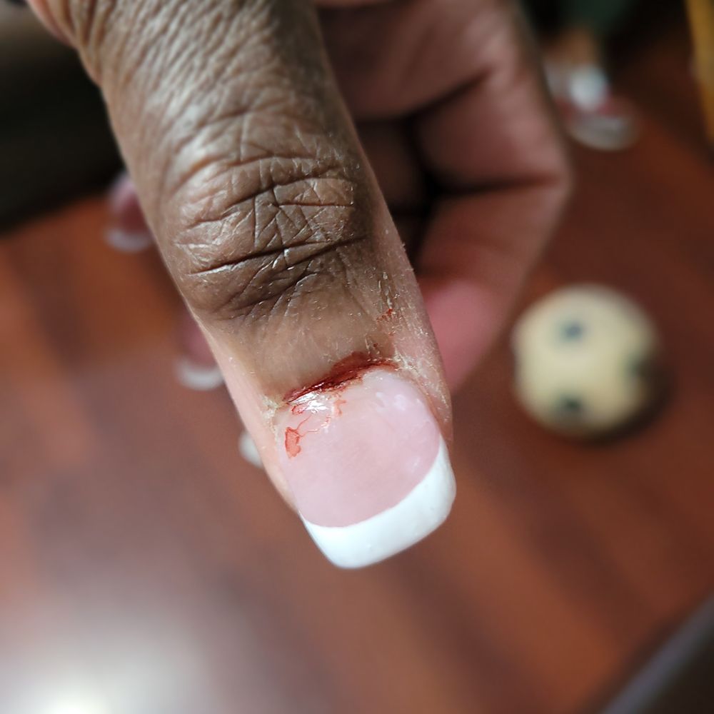 Nail Design - Left thumb still bleeding while I'm home. - Nail Salons Near Me - Sterling, Virginia Nail Design - Left thumb still bleeding while I'm home. - Nail Salons Near Me - Sterling, Virginia