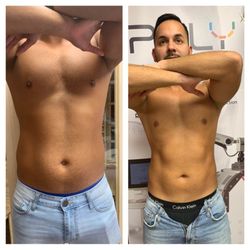 Lotus Skin Care Center - Emsculpt built muscles burn fat. 20k Sit-up in 30mis. After 2 30mins sessions