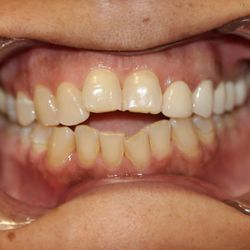 Affinity Smiles Dental Pllc - Cosmetic and Family Dentistry in Roanoke, TX