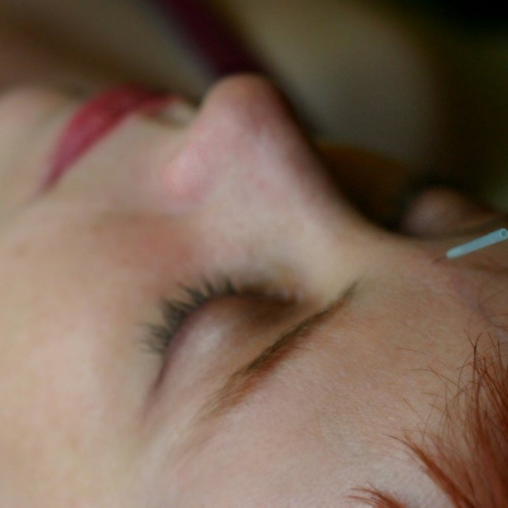 Artemesia Healing Arts - Acupuncture Near Me - Seattle, Washington