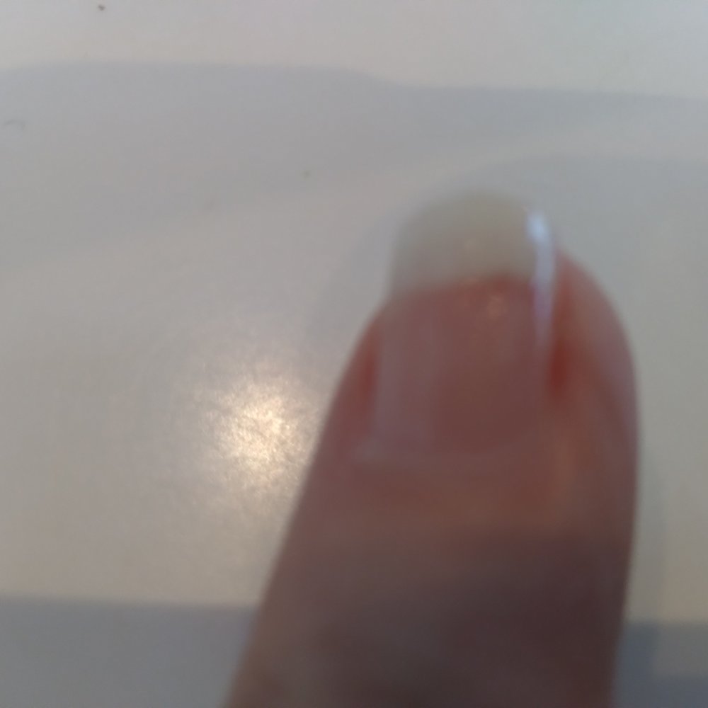 Glow Nail Bar - More nail fungus, just starting under this nail - Nail Salons Near Me - North Charleston, South Carolina
