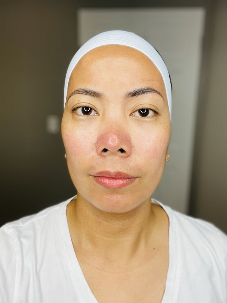 DERMAJUVENATE MED SPA Updated October 2024 10 Photos 12727 Northup Way, Bellevue