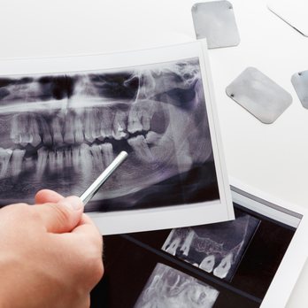 Ballin A Richard, DDS - Panorex X-Ray - Oral Surgeons Near Me - Minneapolis, Minnesota Ballin A Richard, DDS - Panorex X-Ray - Oral Surgeons Near Me - Minneapolis, Minnesota