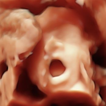 InnerView Ultrasound - Ultrasound Imaging Centers Near Me - Malvern, Pennsylvania InnerView Ultrasound - Ultrasound Imaging Centers Near Me - Malvern, Pennsylvania