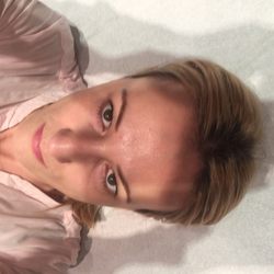 HC Medspa - Me before the treatment