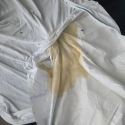 Banner Health System - This is the urin covered bedding this morning