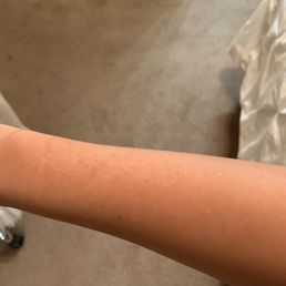 Arm Arm
