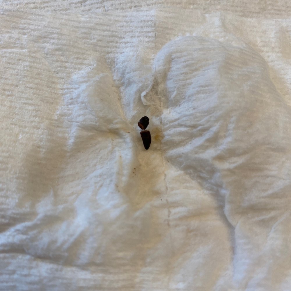 Gordo Taqueria - RAT POOP IN SUPER BURRITO - Mexican Near Me - Albany, California Gordo Taqueria - RAT POOP IN SUPER BURRITO - Mexican Near Me - Albany, California