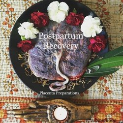Raising Birth Doula Care - Placenta Encapsulation, Tincture, Healing Salve, Keepsake, and Print