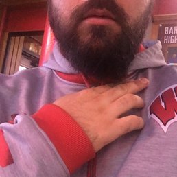 After beard trim. Significantly longer on one side. After beard trim. Significantly longer on one side.